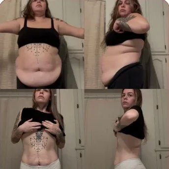 Sofia's before and after photos