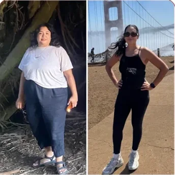 Jacqueline's before and after photos