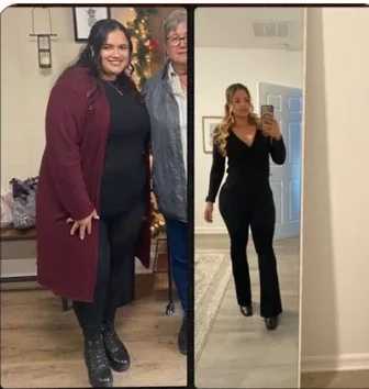Mia's before and after photos